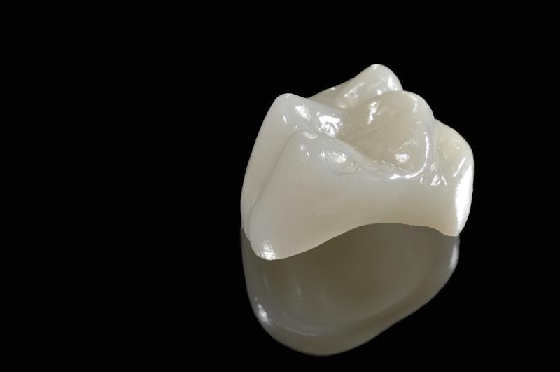 Porcelain Crowns Street Cooper City, FL